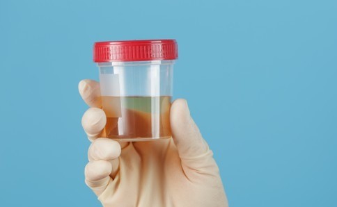 Picture for category Urinary - Test & Collection Supplies